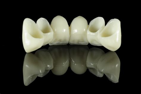 albarillo dental clinic|10 units Porcelain .